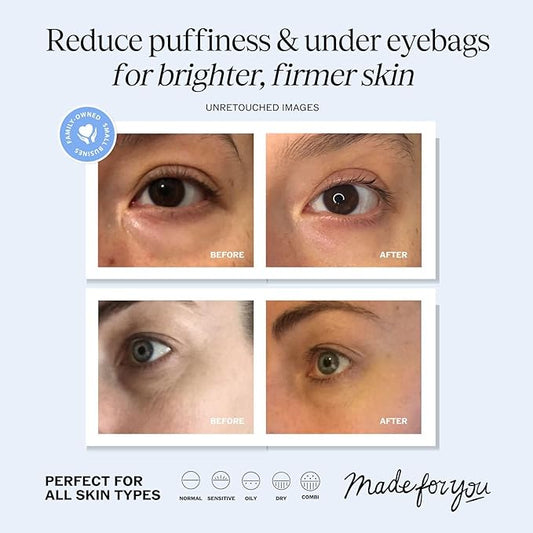 LilyAna Naturals Eye Cream for Dark Circles and Puffiness, Under Eye Cream for Wrinkles and Bags, Anti Aging - helps Improve Dryness; for Sensitive Skin - 1.7 oz - Made in USA
